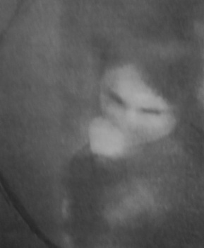 la fillette aux yeux noirs de la forêt de Cannock Chase